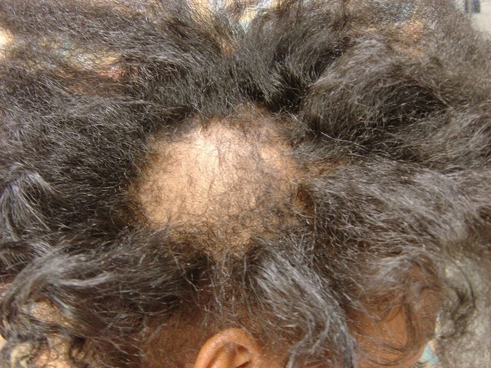 الفحوصات الطبية مجرد جزء من العملية التشخيصية وبتفسر حسب السردية الكاملة لل