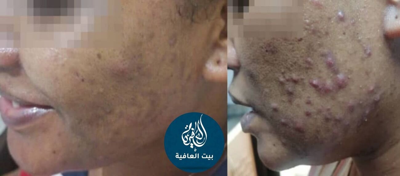 الصبر مفتاح الفرج