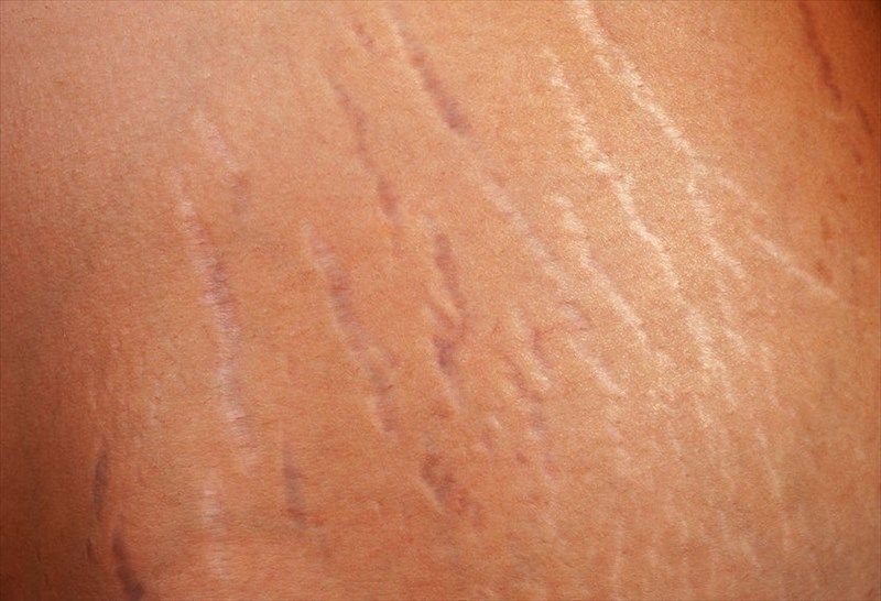 هل يمكننا دمج العلاجات الموضعية لتحسين النتائج؟ 🧪✨