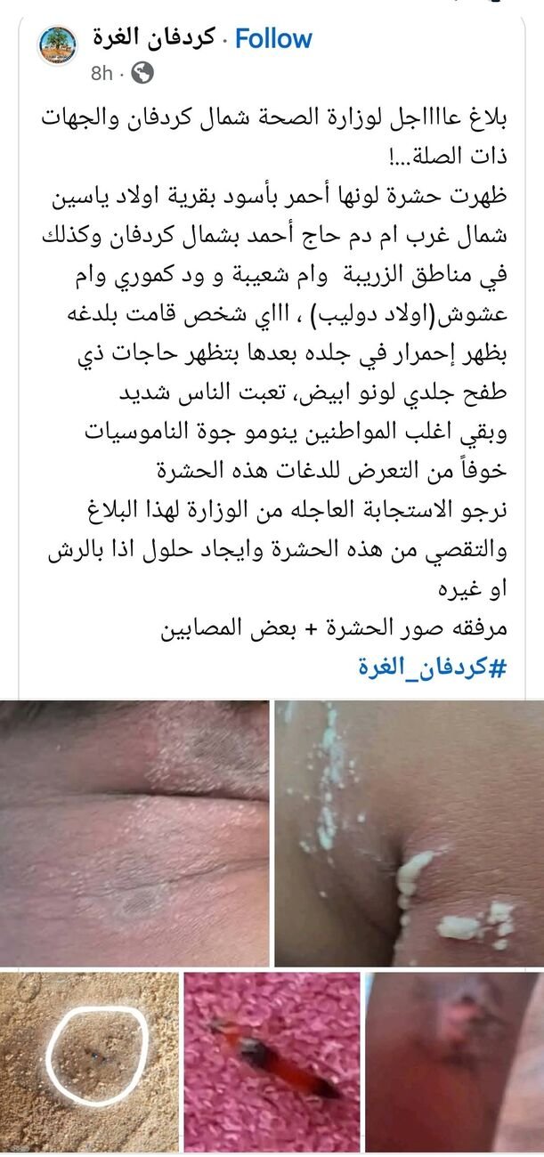 📢 تنبيه صحي عاجل لأهالي شمال كردفان والمناطق المتأثرة