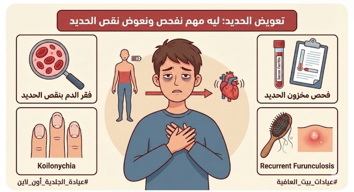 ليه مهم نفحص ونعوض نقص الحديد