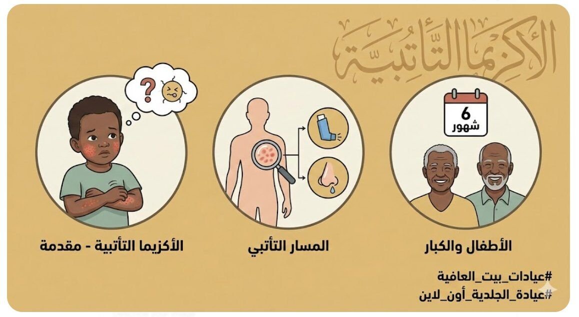 الاكزيما التأتبية - مقدمة