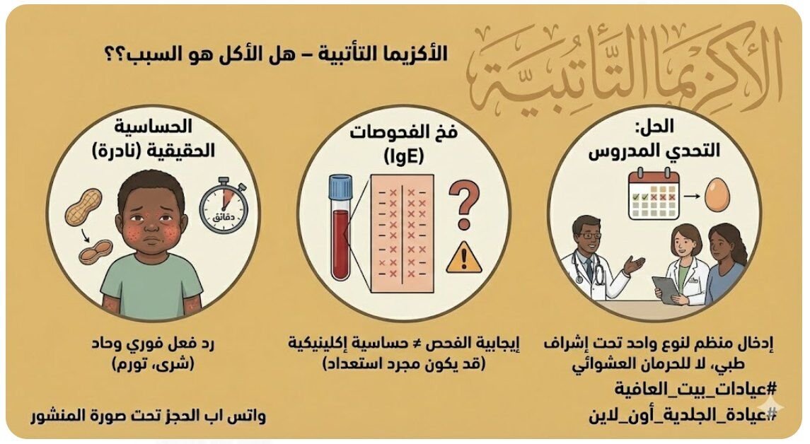 الاكزيما التأتبية – هل الأكل هو السبب؟؟