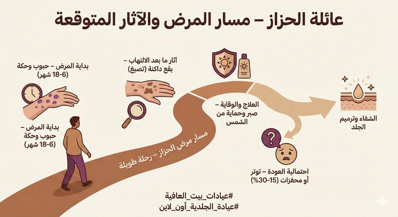 مسار المرض والآثار المتوقعة