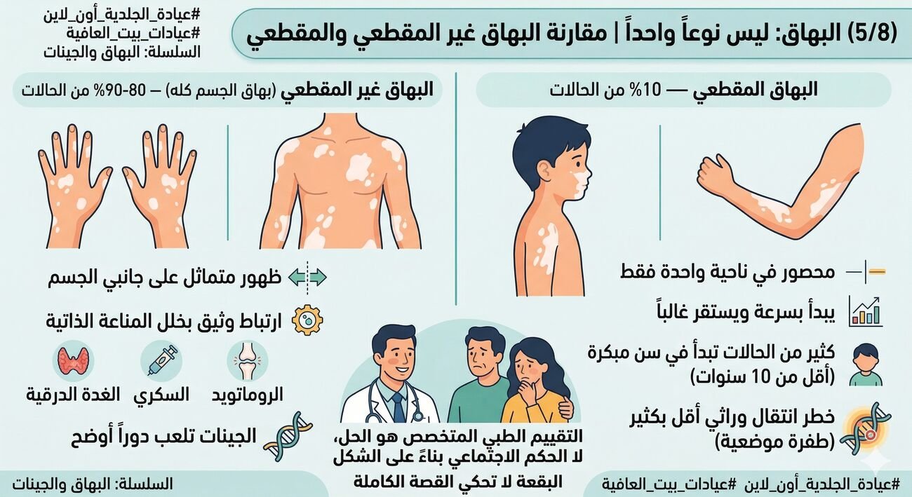 البهاق القطعي وبهاق الجسم كله - ما كلو نوع واحد