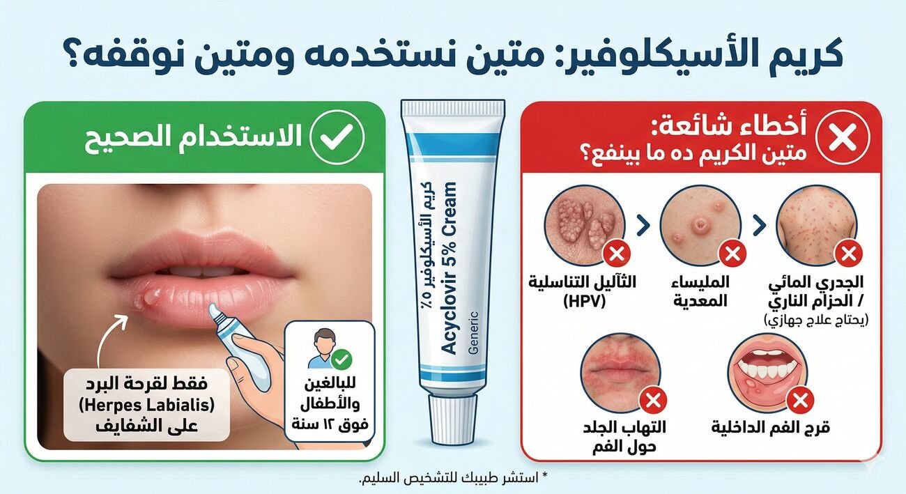 كريم الأسيكلوفير: متين نستخدمه ومتين نوقفه؟ 🧴