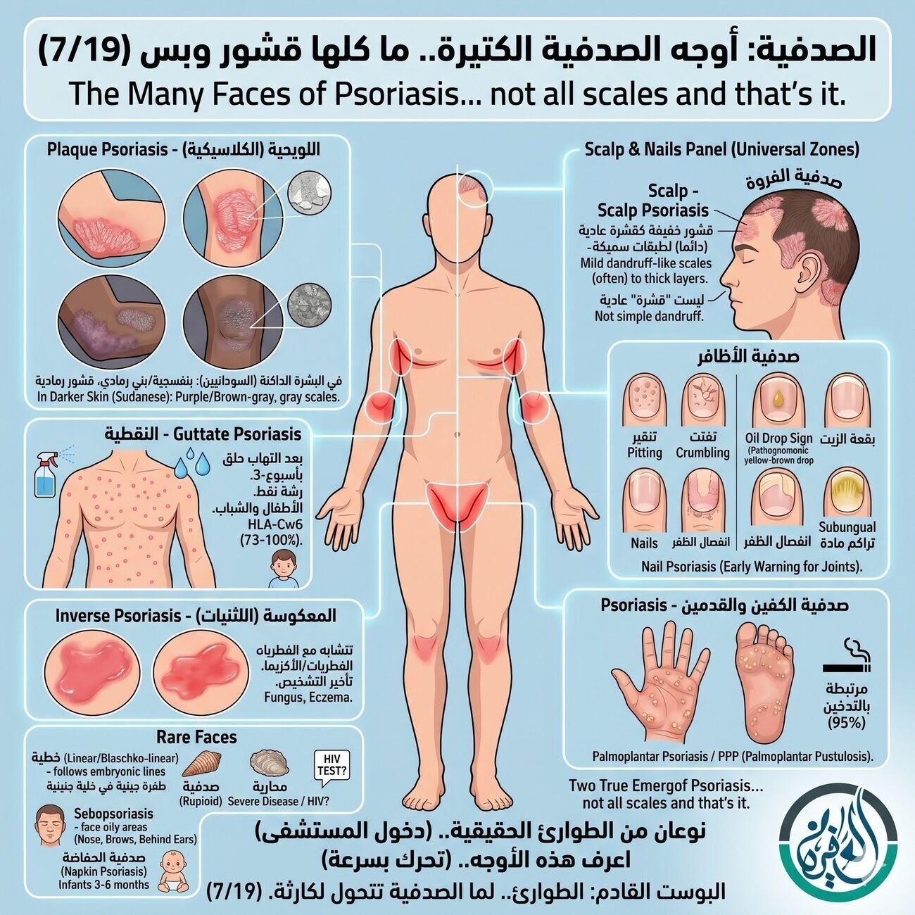 أوجه الصدفية الكتيرة.. ما كلها قشور وبس