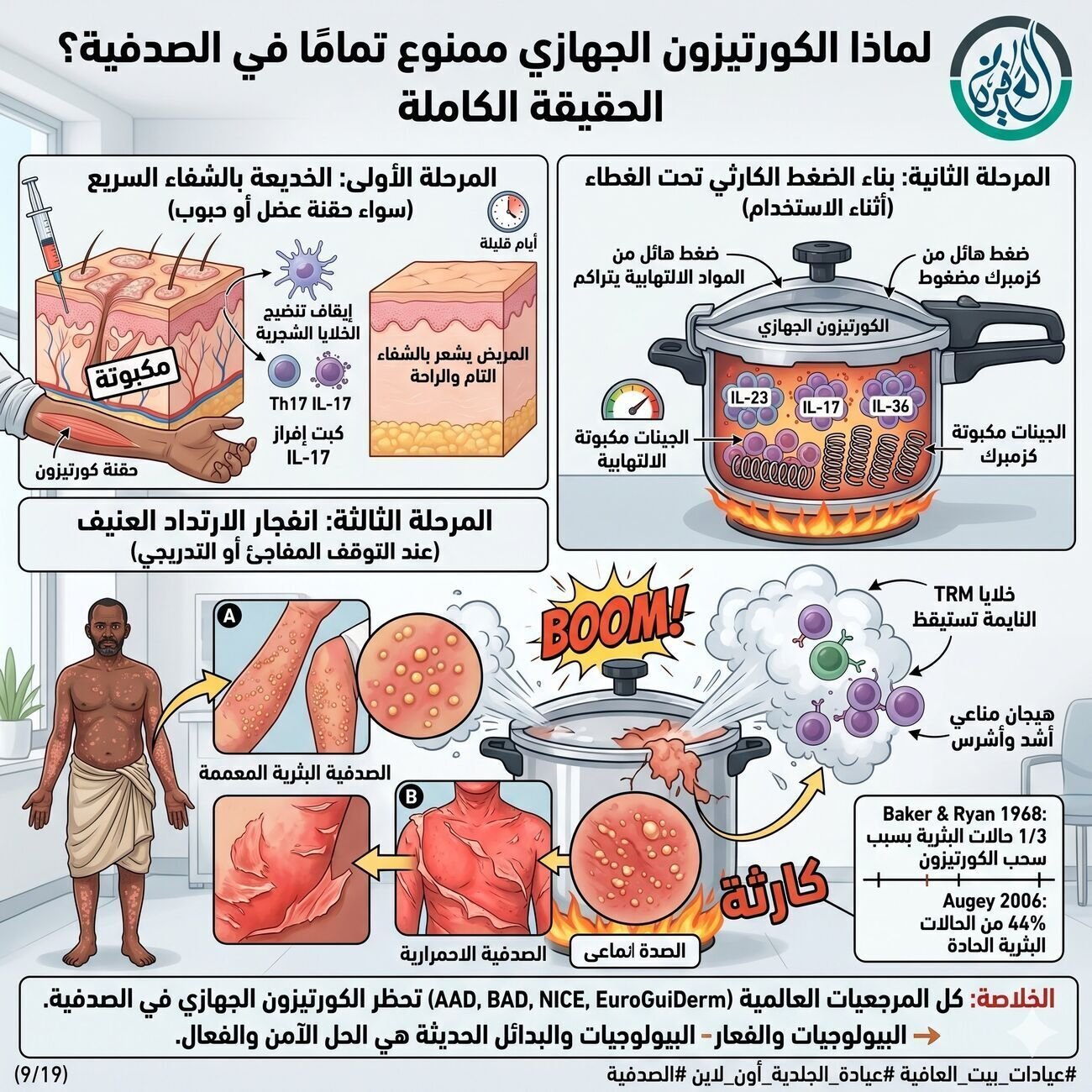 الكورتيزون والصدفية.. ليه ممنوع؟