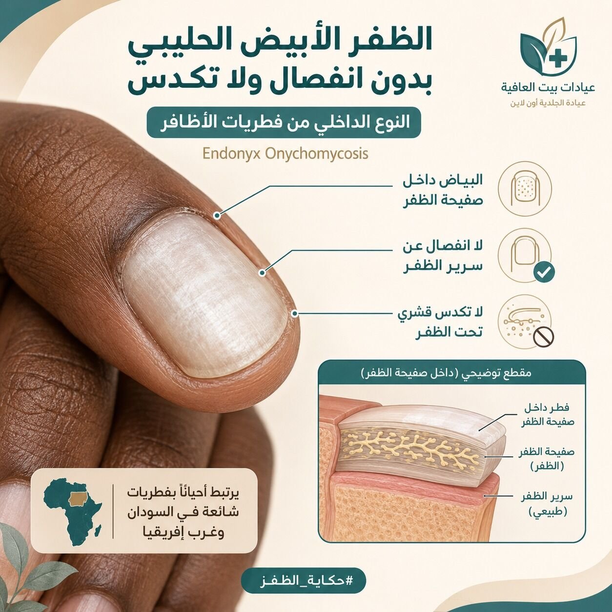 الظفر الأبيض الحليبي بدون انفصال ولا تكدس - النوع الداخلي من الفطريات