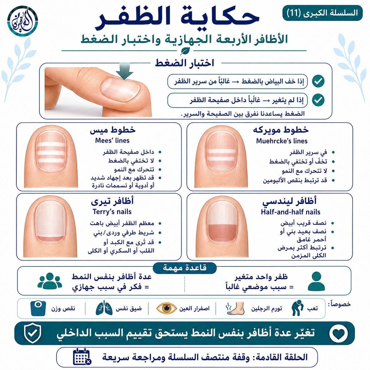 الأظافر الأربعة الجهازية واختبار الضغط