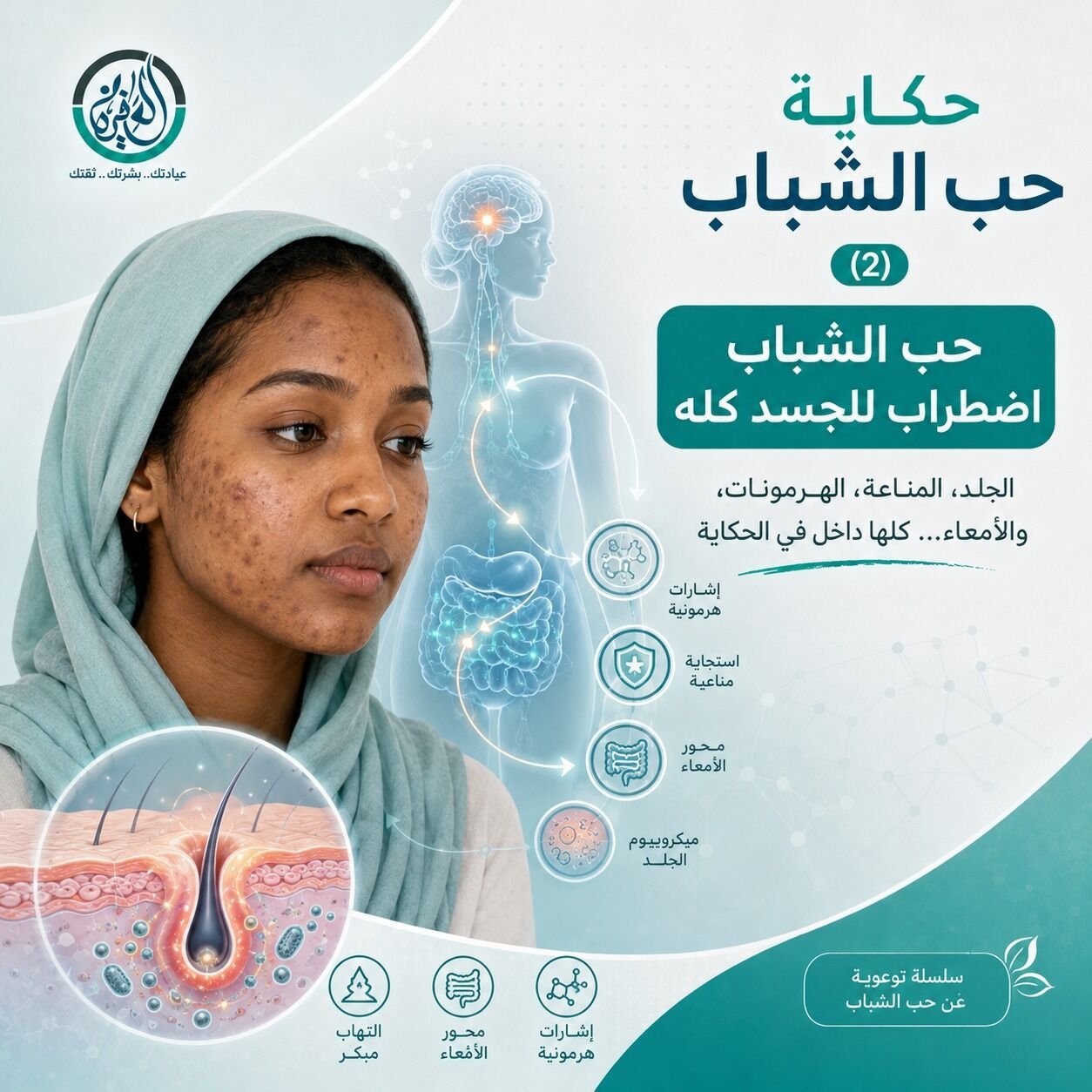 حب الشباب اضطراب للجسد كله
