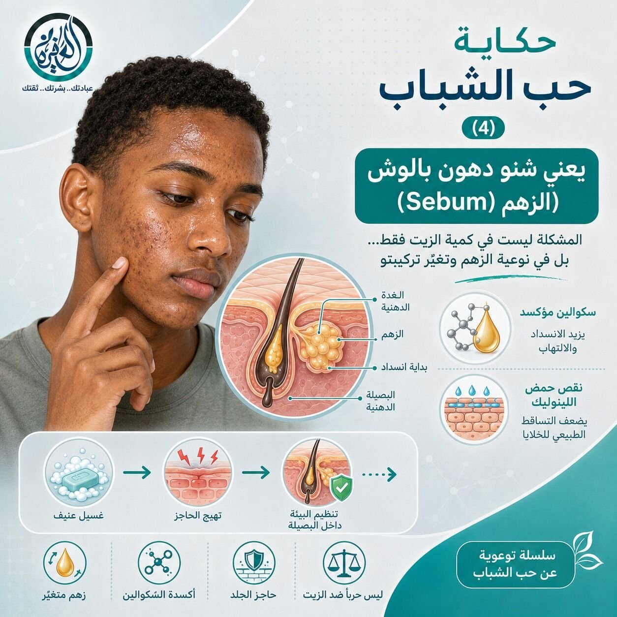 يعني شنو دهون بالوش (الزهم Sebum )