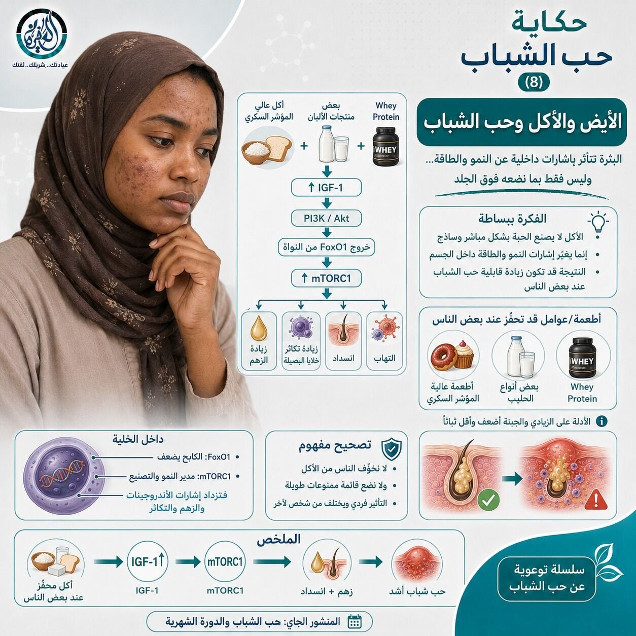 الأيض والأكل وحب الشباب