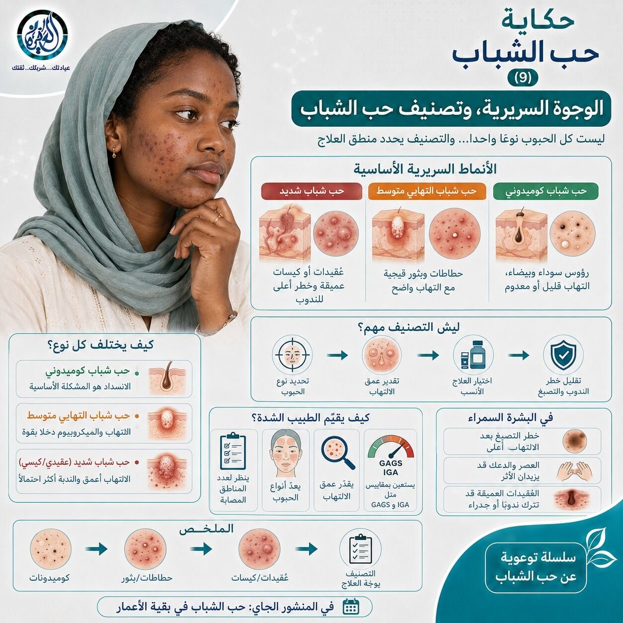 الوجوه السريرية، وتصنيف حب الشباب