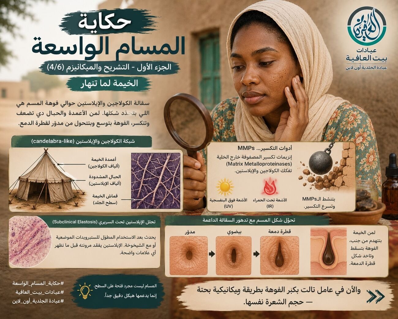الخيمة لما تنهار