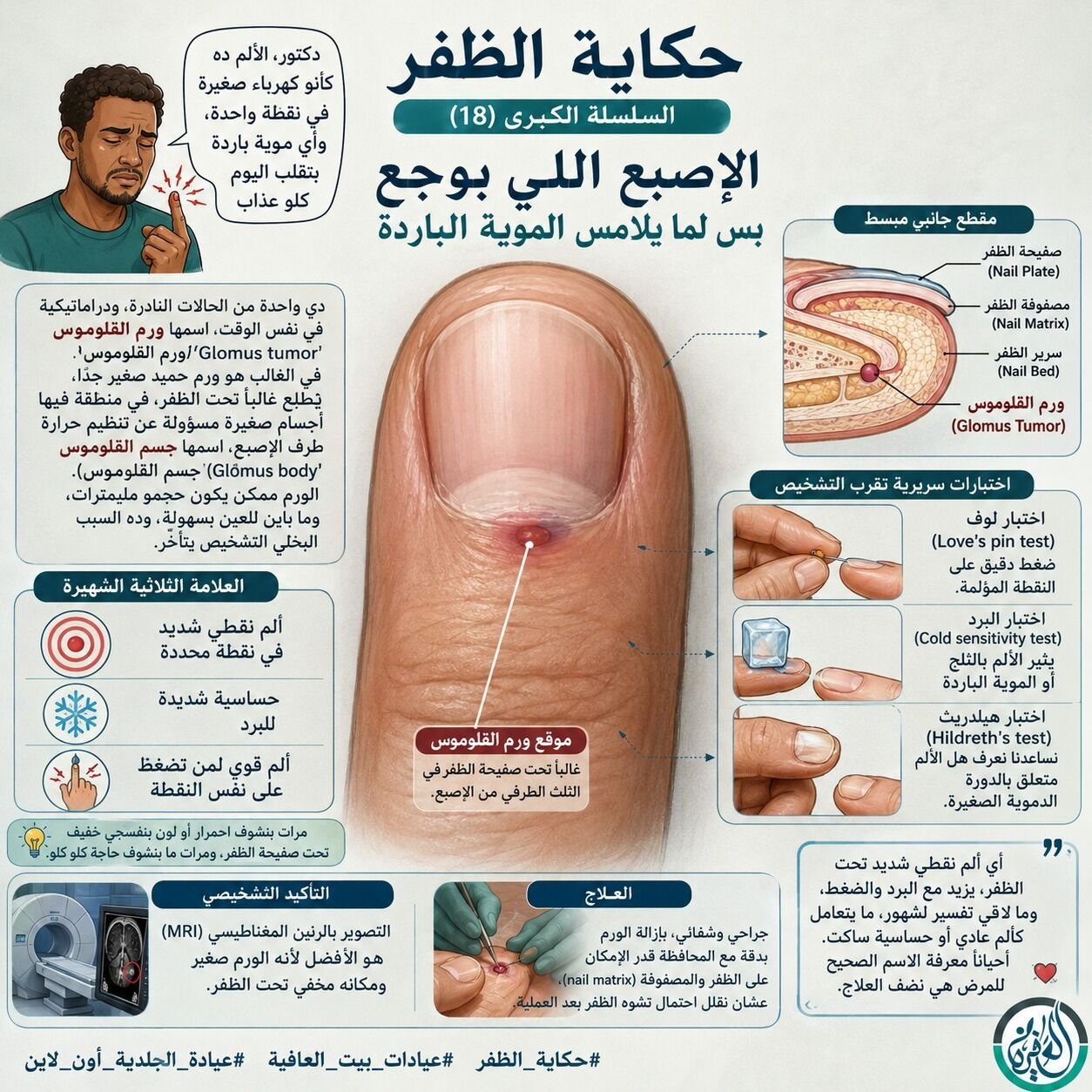 الإصبع اللي بوجع بس لما يلامس الموية الباردة