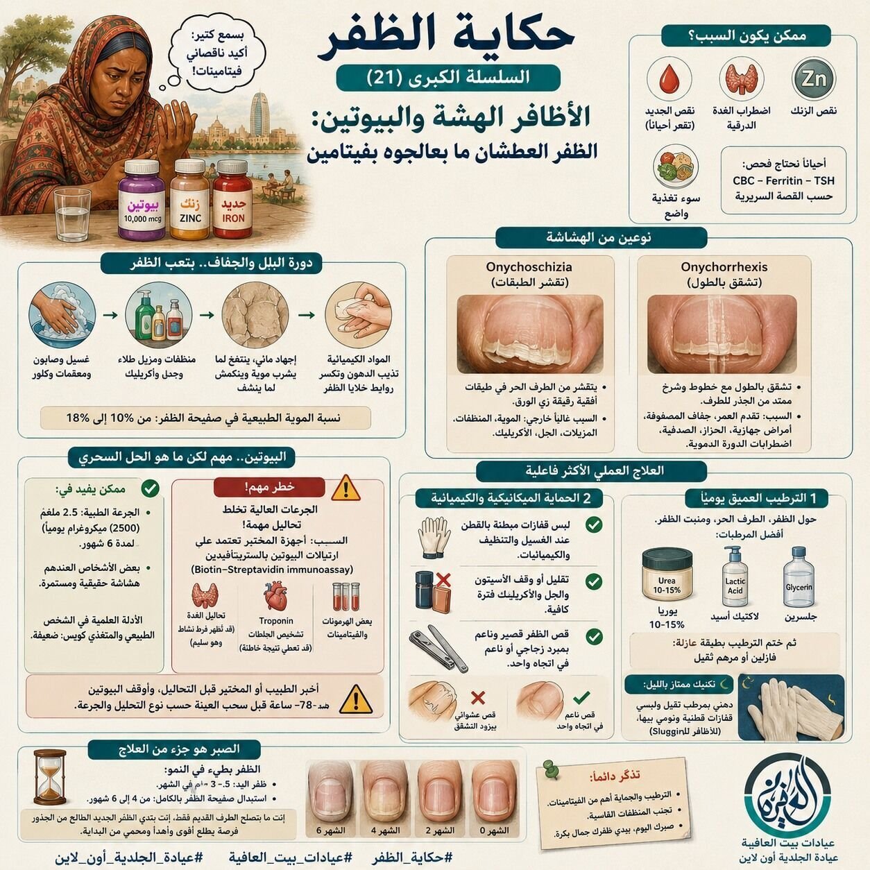 الأظافر الهشة والبيوتين: الظفر العطشان ما بعالجوه بفيتامين
