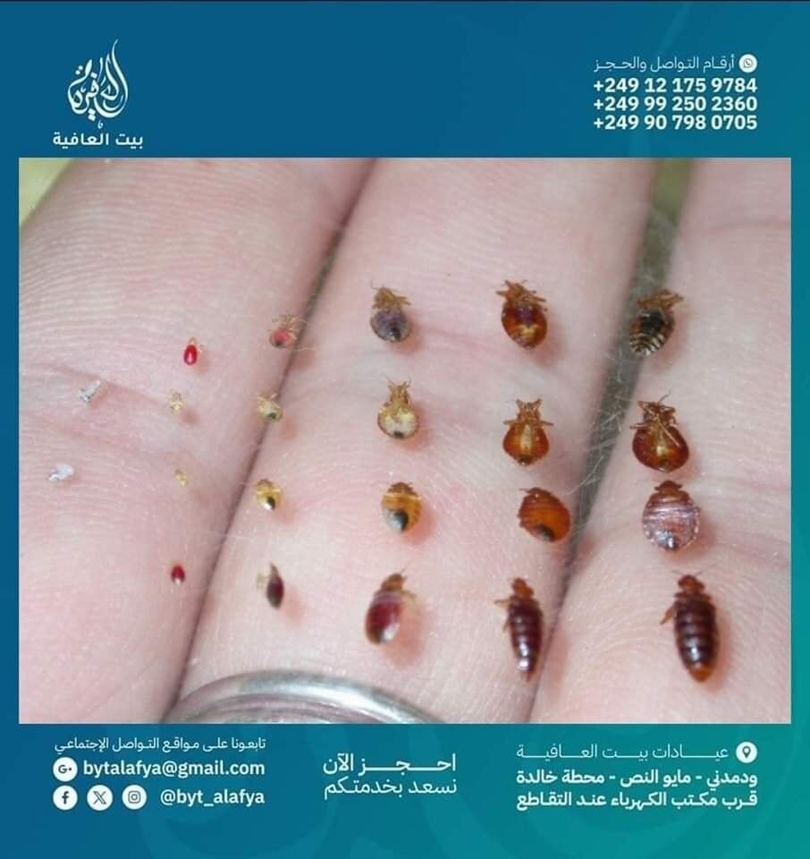 🛏️🐜 علامات وجود بق الفراش