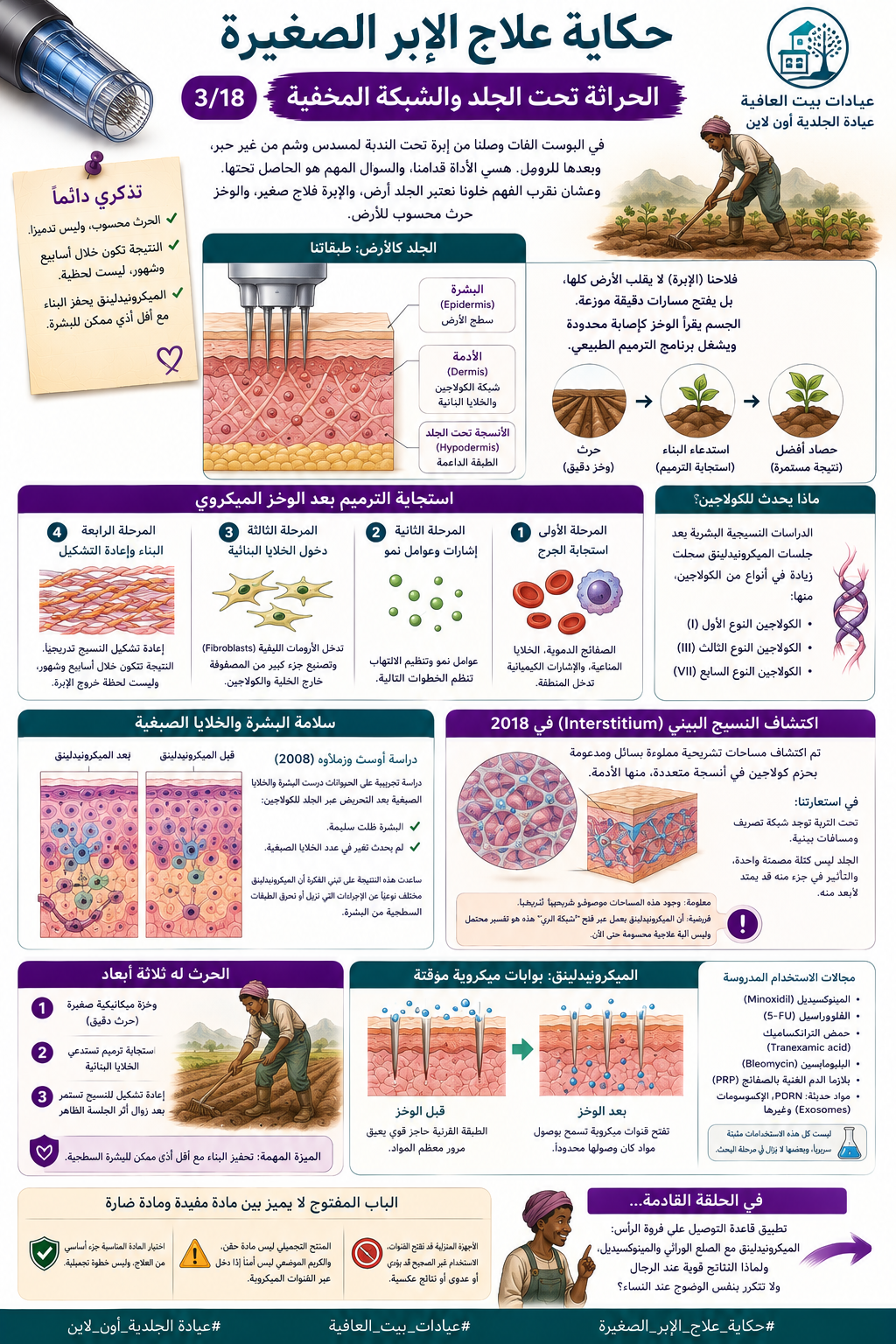 حكاية علاج الإبر الصغيرة ٣/١٨ - الحراثة تحت الجلد والشبكة المخفية